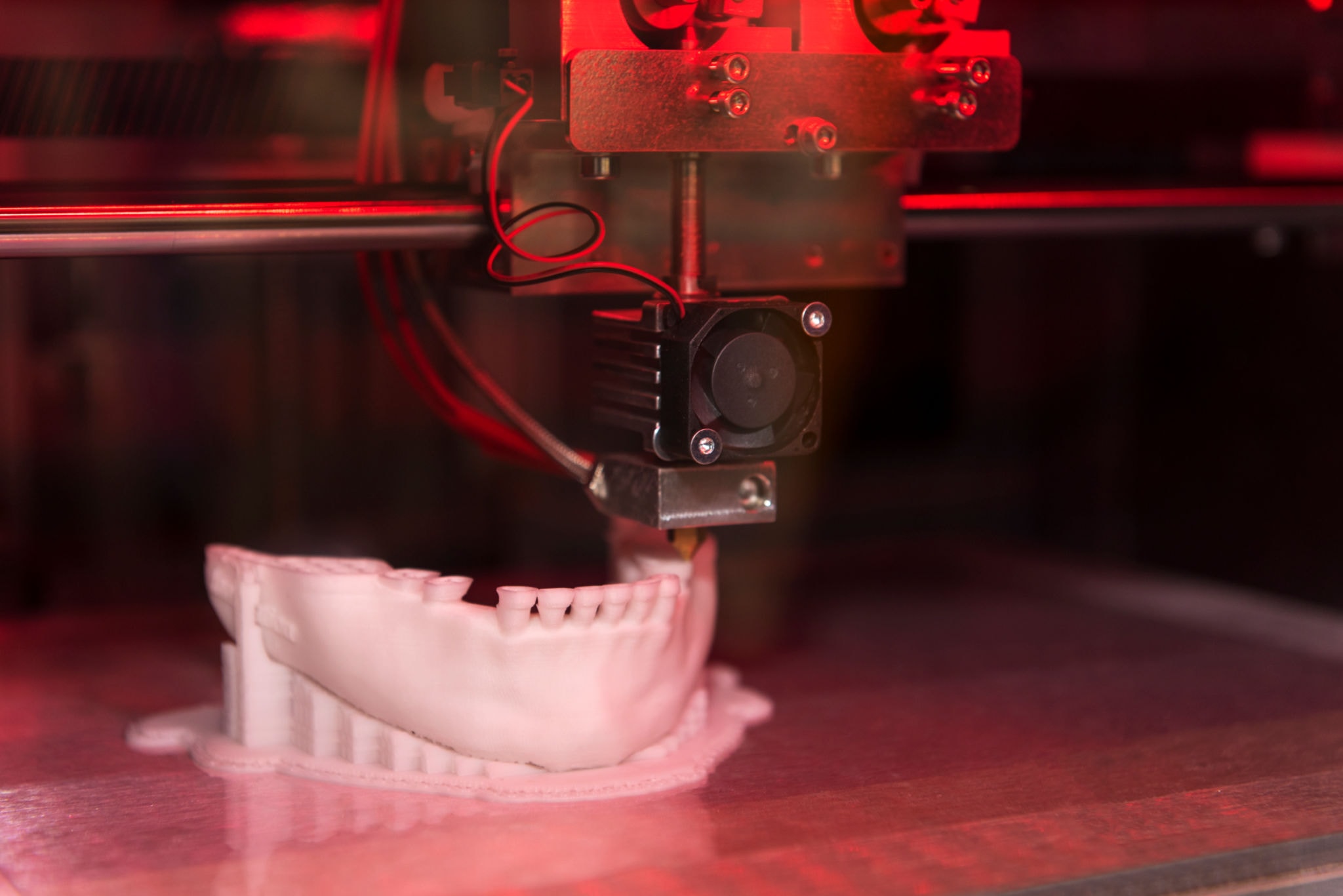 Medical 3D printer producing a dental model